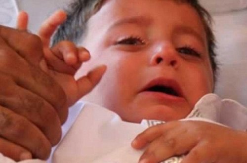 Evdə sünnət faciəylə bitdi - FOTO