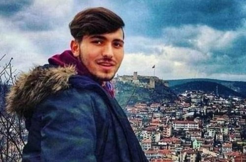 Diş ağrısı səbəbilə həkimə getdi, xərçəng olduğunu öyrəndi - Tələbənin acı həyatı - FOTOLAR