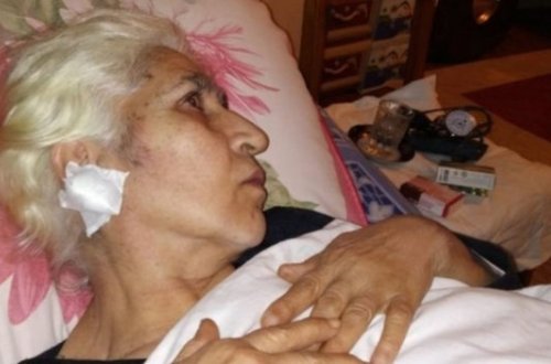 Erməni gülləsinə tuş gələn qadın danışdı: 