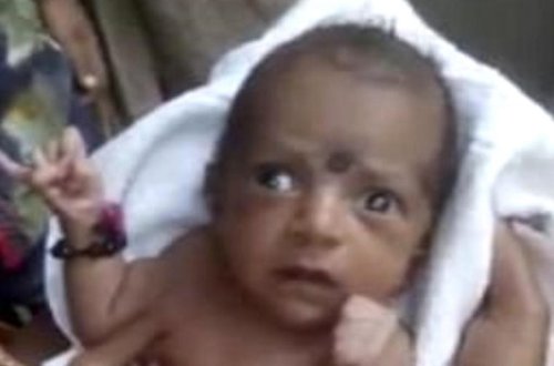 Hindistanda 3 qollu uşağı Allah bilib, ibadət etdilər - VİDEO - FOTO