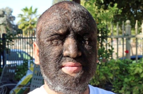 Dünyanın ən tüklü insanı - Hamı ondan danışır - FOTOLAR