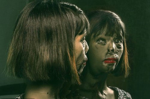 Qız doğulduğuna görə atası tərəfindən işgəncəyə məruz qaldı: Kislota ilə... - FOTOLAR