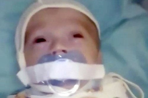 Şok kadrlar: doğum evində körpənin ağzına skotç vurdular - VİDEO - FOTO