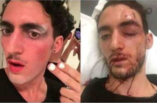 Qarabağa qanunsuz səfər edən homoseksualı bu hala saldılar - FOTO