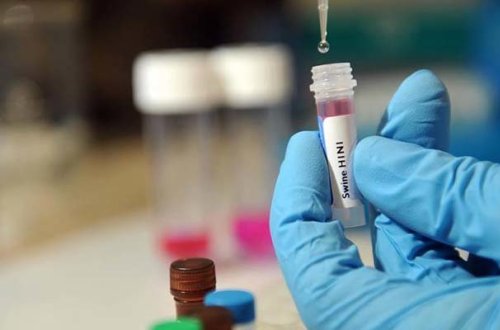 Gürcüstanda daha 1 nəfər 