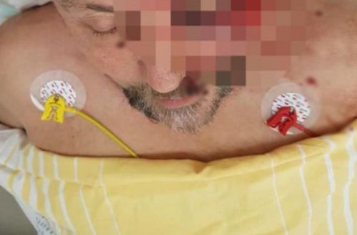 3 kişi birləşərək deputatı vəhşicəsinə döydü ( + 18 FOTO )