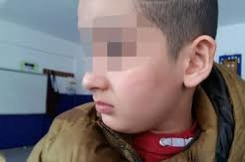 Müəllim ağır xəstəlikdən əziyyət çəkən şagirdi döydü, nazirlik işə qarışdı - VİDEO