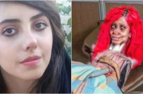 Tanınmaz halda olan qız 