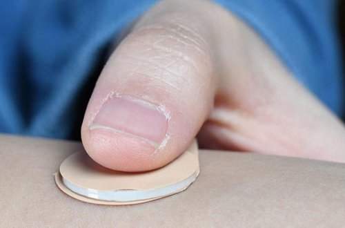 Qadınlar üçün hamiləlik əleyhinə yeni mikroplastır icad olundu - 1 ay qoruya biləcək