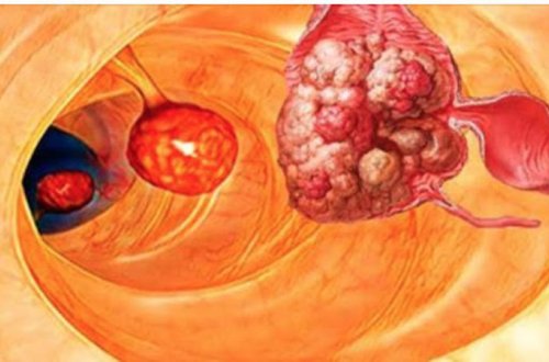 Bütün xəstəliklərin yaranma səbəbi BU İMİŞ - Məşhur cərrahdan İNANILMAZ ARAŞDIRMA