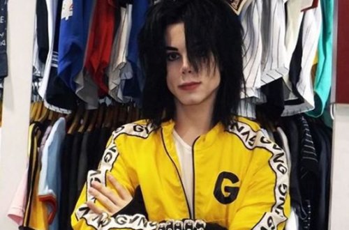 Maykl Ceksona bənzəmək üçün 11 əməliyyat keçirdi - FOTO