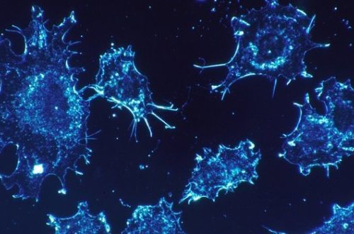 Orqanizmi xərçəngdən qorumağın yolu tapıldı