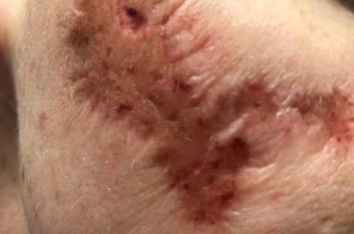 33 yaşlı qadının bədəni çürüməyə başladı, müayinənin nəticəsi şoka saldı - FOTOLAR