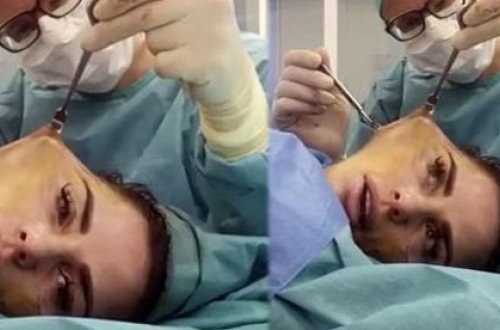 Məşhur aktrisa üzünü dartdırmışdı, bu da son görüntüsü - FOTOLAR