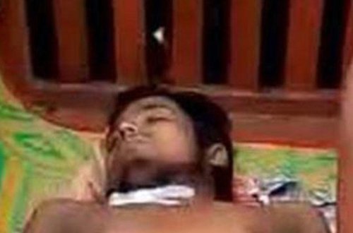 Qarnı ağrıdığına görə xəstəxanaya gedən kişinin cinsiyyət orqanını oğurladılar - FOTO