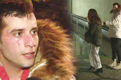 Sevgilisinin üzünü cızması filminin çəkilişini dayandırdı