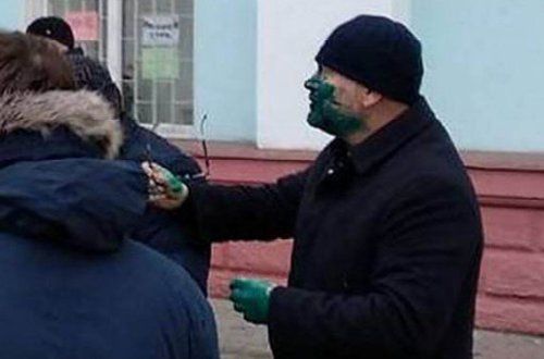 Prezidentliyə namizədin üzünə 