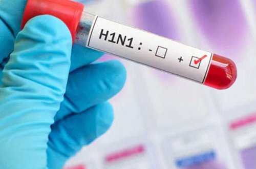 Baş epidemoloq: “Bu virus hər kəsdə var…”