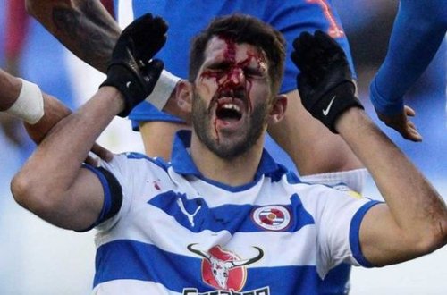 İngiltərədə müdafiəçi hücumçunun üzünü tapdaladı - FOTO/VİDEO