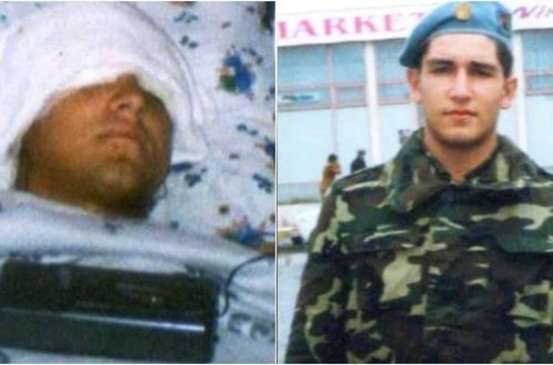 Cəbhədə snayperlə gicgahından vurulan İlham Zəkiyevin xəstəxanadan FOTOSU