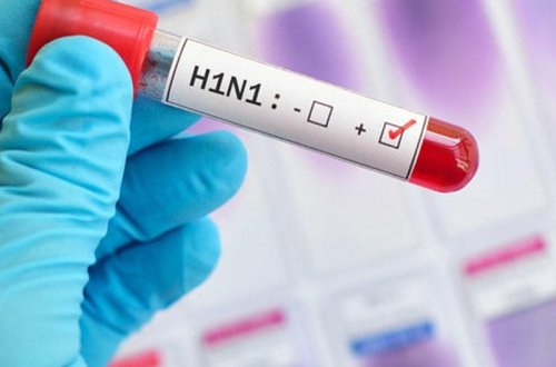 Gürcüstanda azərbaycanlıların yaşadığı rayonda “donuz qripi”ndən bir nəfər öldü