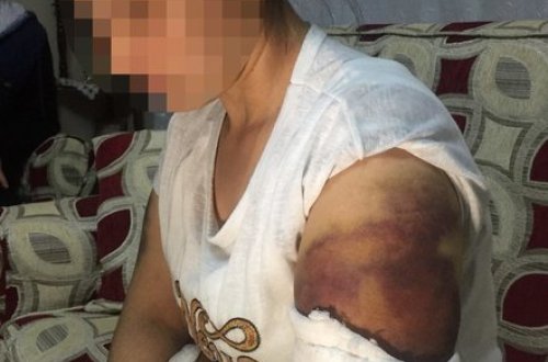 Ailə vəhşəti! 30 dəqiqə həyat yoldaşını inşaat dəmiri ilə... FOTOLAR (18+)