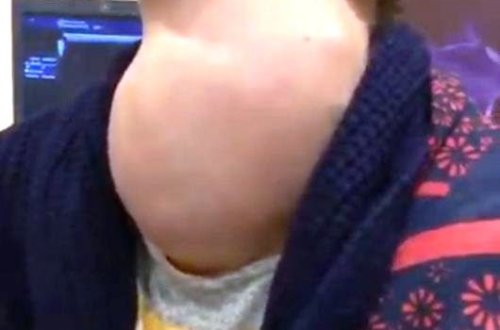 Azərbaycanda xəstənin zobu hər kəsi dəhşətə gətirdi – Video