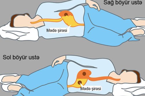 Nə üçün sol böyür üstə yatmaq lazımdır?