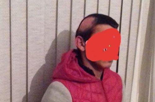 Azərbaycanda GÖRÜNMƏMİŞ OLAY - 17 yaşlı yeniyetməyə yaxınları işgəncə verdi və..