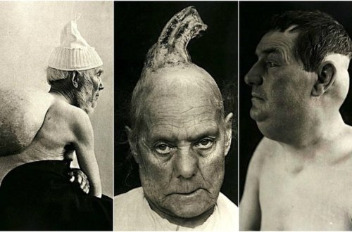 Başındakı buynuzla gəzən qadının fotoları görənləri dəhşətə gətirir