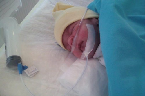 Прекрасная новость: аноним пожертвовал 21 тысячу долларов на спасение Димы Орешина