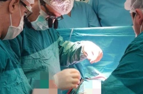 Xəstəyə süni ürək köçürən azərbaycanlı həkim maraqlı FAKTLARI AÇDI - VİDEOMÜSAHİBƏ