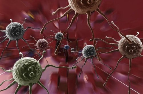 Xərçənglə bağlı İNQİLABİ KƏŞF: Türkiyənin bu cihazı bütün xəstələri sağaldacaq