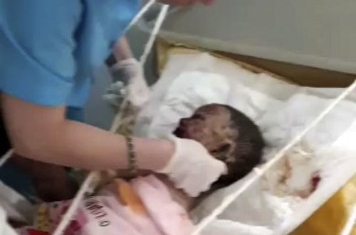 Azərbaycanda dəhşət: atası yanan körpənin müalicəsinə razı deyil? - VİDEO