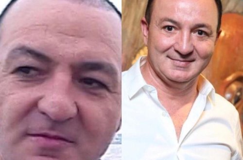Vasif üzünə botoks etdirib? - Foto
