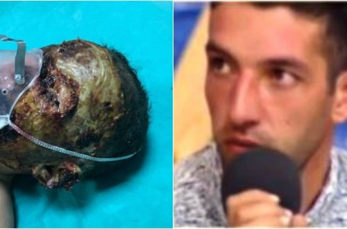 Azərbaycanda 2 yaşlı uşağın üzünə benzin töküb yandırdılar - Atasından ŞOK SÖZLƏR (+18 FOTOLAR)