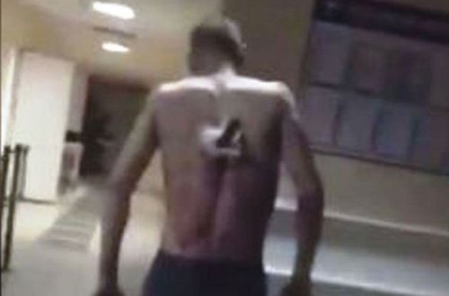 Tatarıstanda yaralı kürəyində bıçaqla siqaret çəkməyə çıxdı - VİDEO