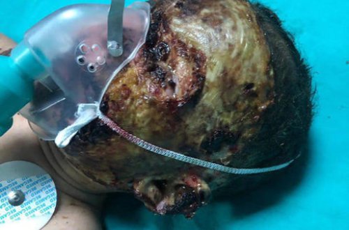 Üzünə benzin töküb yandırılan uşaqla bağlı daha bir dəhşətli xəbər: Anası körpəni satmaq istəyirmiş