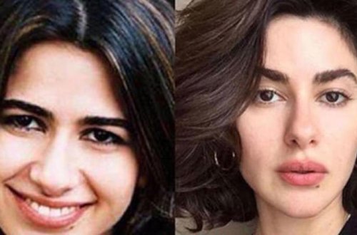 Nəsrindən estetik əməliyyat ittihamlarına iynəli cavab - FOTO