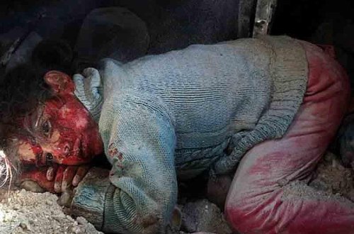 Uşaqların böyüklər kimi öldürüldüyü ölkə - FOTO