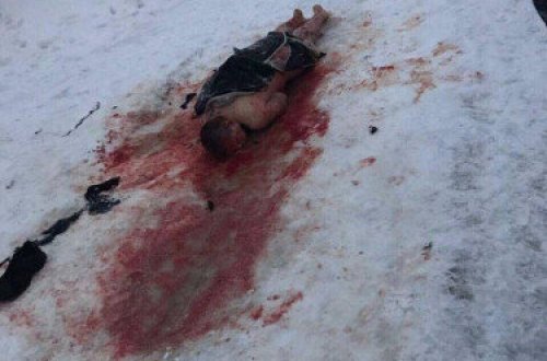 Dəhşətli HADİSƏ: Küçə itləri 25 yaşlı gənci parçalayıb öldürdü - FOTO