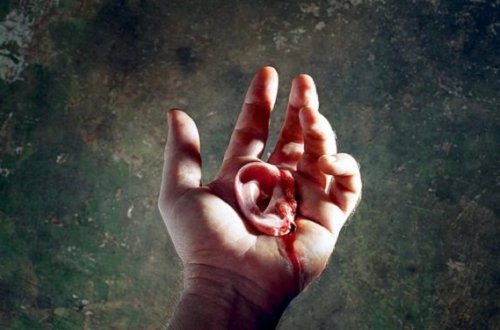 Gəncədə ər arvadının qulağını kəsdi — SƏBƏB