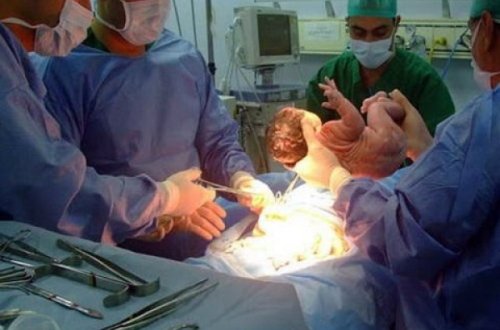 Azərbaycanda faciə: Doğuş zamanı körpə öldü