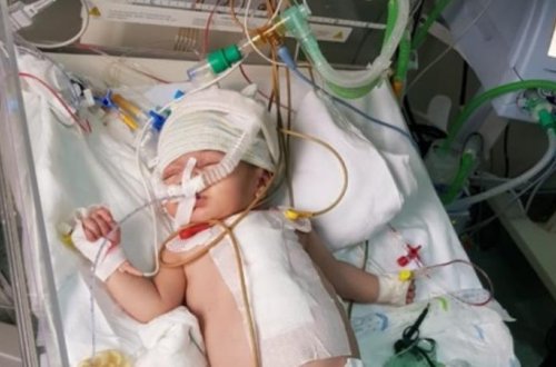 Azərbaycanda iki aylıq körpənin üzərində uğurlu əməliyyat - FOTO