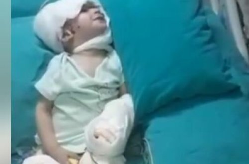 Bakıda üzü benzinlə yandırılan 2 yaşlı uşağın son vəziyyəti necədir? - Xəstəxanadan VİDEOSU YAYILDI