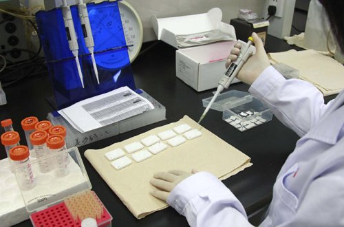 Tibb tarixində nadir hadisə: Xəstə QİÇS-dən qurtuldu