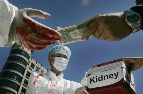 Dünyada qanunsuz orqan alveri pik həddə çatdı