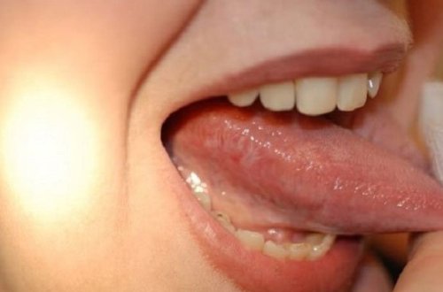 Dil xərçənginin 5 əlaməti