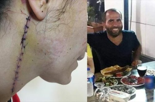 DƏHŞƏT! Yolunu kəsib bu hala saldı/ FOTO