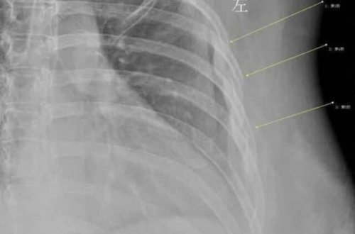 Gündə 10 stəkan içdi - başına bu hadisə gəldi/ İDDİA- FOTO